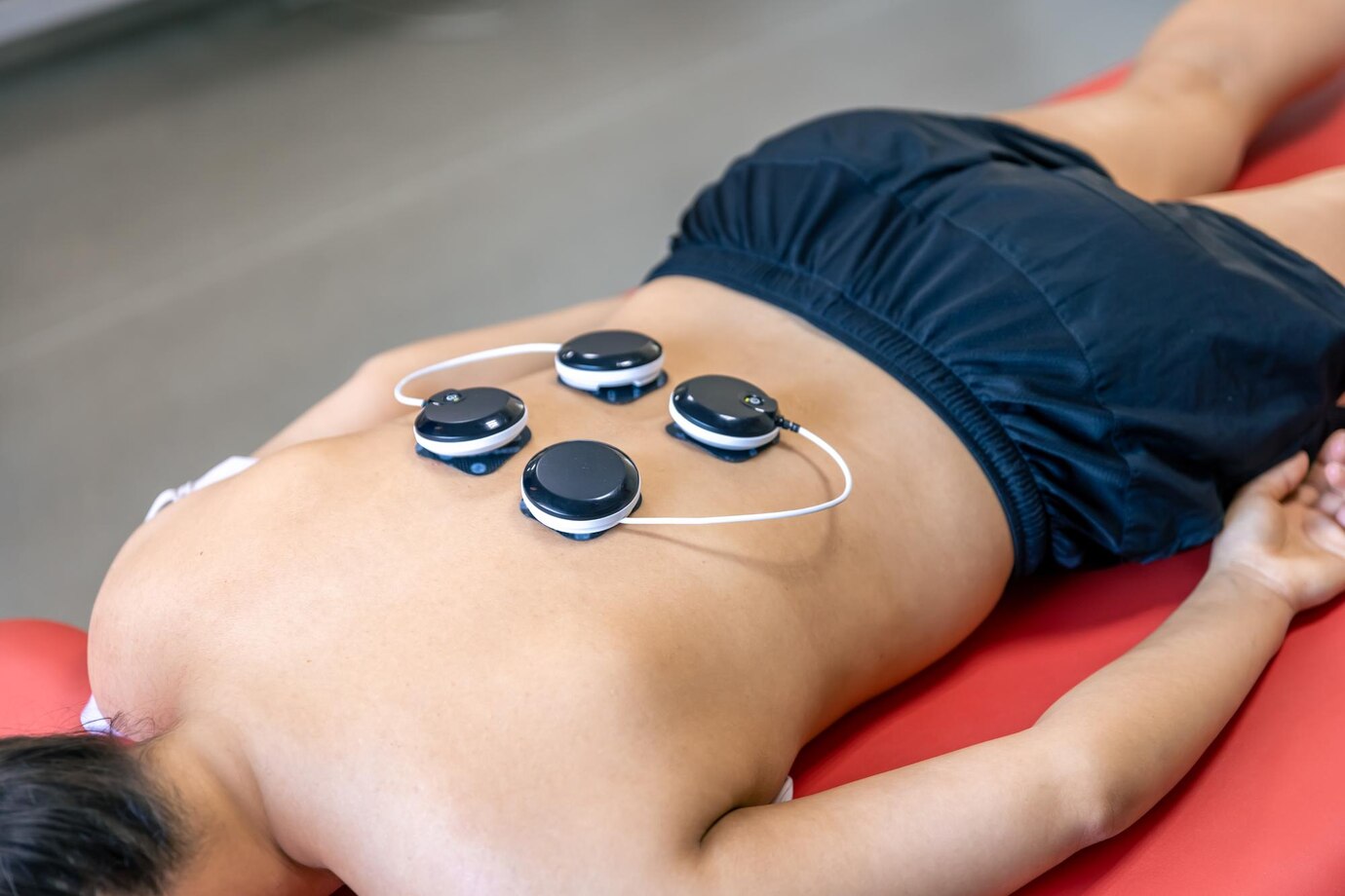 tratamiento-mioestimulacion